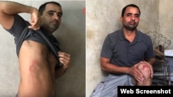 Enrique Díaz Rodríguez muestra las lesiones sufridas durante el arresto.