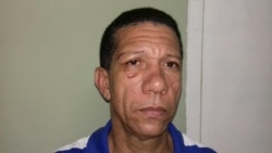 Ovidio Martín Castellanos, coordinador de UNPACU, golpeado el jueves 20 de abril de 2016 Ovidio Martín Castellanos, coordinador de UNPACU, golpeado el jueves 20 de abril de 2016