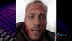 Muere abatido por tropas de Maduro el expolicía rebelde Oscar Pérez Muere abatido por tropas de Maduro el expolicía rebelde Oscar Pérez