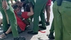 Denuncian secuelas de brutal golpiza a prisionero político en Matanzas Denuncian secuelas de brutal golpiza a prisionero político en Matanzas