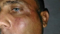 Declaraciones de Zaqueo Báez Declaraciones de Zaqueo Báez